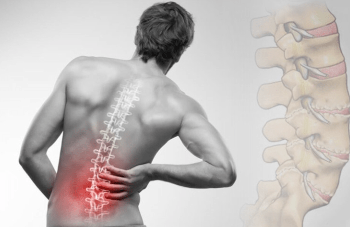 Giảm đau lưng hiệu quả rõ rệt cho người tập Plank
