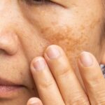 cachChăm Sóc Da Sau Tuổi 30