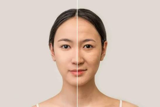 Cách Chăm Sóc Da Khi Bắt Đầu Xuất Hiện Dấu Hiệu Lão Hóa