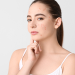 Chăm Sóc Da Hỗn Hợp Đúng Cách