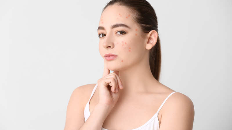 Chăm Sóc Da Hỗn Hợp Đúng Cách